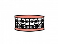 歯列矯正のイラス…