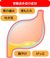 胃酸過多症の症状…