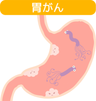 胃がんアイコン（…