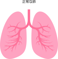 正常な肺アイコン…