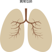 異常な肺アイコン…