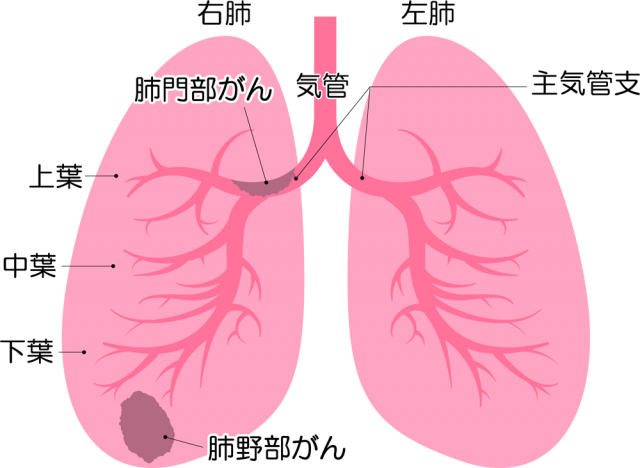 肺がんアイコン Csai Png 無料イラスト素材 素材ラボ