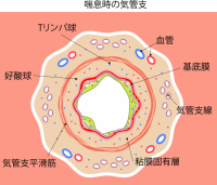 喘息時の気管支ア…