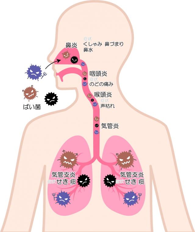 ウィルスが入って風邪を引くイラスト Csai Png 無料イラスト素材 素材ラボ