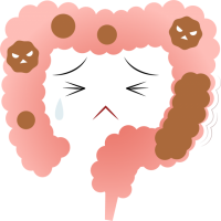 便秘気味な大腸(…