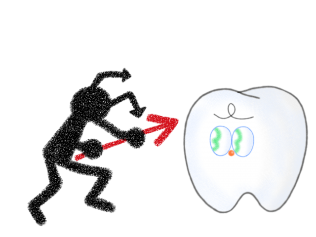 虫歯菌と歯 無料イラスト素材 素材ラボ